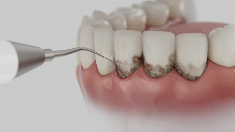 Reliable Dental Implants contractor in Timpson, TX by Smile Center Dentistry